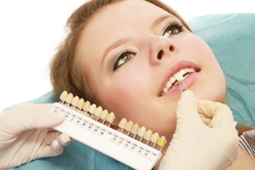clareamento-dental 