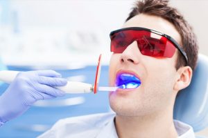 clareamento dental